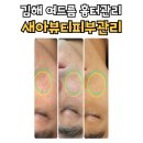 늘새아 | 김해 여드름 흉터관리 새아뷰티피부관리 5회차 내 돈 내산 후기