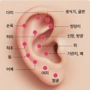 이혈 테라피 이미지