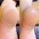 티오PC | 춘천 패디플래닝 여름 샌들 신기전 필수코스 뷰티오로라엘 본점