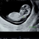 전한나산부인과의원 이미지