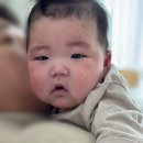 선경약국 | 4개월 아기 감기 모세기관지염 의심 설연휴 수원아이편한병원 후기