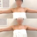 청담피부관리 드레스라인 달라진 느낌, 디유에스테틱 청담점 웨딩 팔 슬리밍 후기