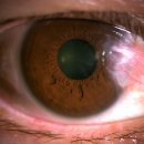 서울퍼시픽안과의원 이미지