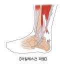 건은