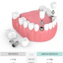 비타민치과기공소 이미지