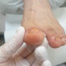 푸스케어대전신탄진점 네이버블로그