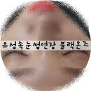 블랙온즈