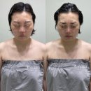 세븐일레븐광주광산환영점 | 첨단에스테틱 광주 얼굴 윤곽관리 체계적으로 잘하는 에스테티아 첨단1호점 후기