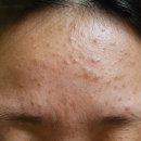 이소약국 | 이소켈리 효과 내돈내산 후기 토너 세럼 크림 3개월 변화