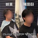 평택비젼센타 | 평택 두피관리 맛집 'CSLMGF 두피탈모센터 평택비전점' 남친 데리고 다녀온 솔직 후기!