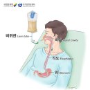 구내염으로 착각하기 쉬운 설암…입안 궤양 잘 낫지 않으면 ‘설암’ 의심 이미지