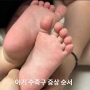 아기 수족구 증상 순서 13개월 아기 완치 후기