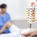 “수술 후 누워만 있으면 근육 빠진다”… 척추 수술 전후, 어떻게 관리해야 할까? ④ [척추건강연구소] 이미지