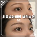 메디럭스 | 시흥속눈썹펌 추천, 은행동 뷰티수연 솔직후기