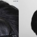 인왕초등학교 | 홍제동두피문신, 지루성두피 때문에 망설이는 분들 꼭 읽어보세요