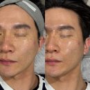 1898 | 대전 갈마동 피부관리 에이아이앤비 뷰티 수분재생관리 후기