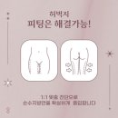 피팅의원
