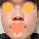 컴플렉스케어 네이버블로그
