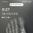 Simple5 향방 이미지