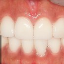 명품치과기공소 이미지