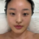 사창산 | 청주 윤곽관리 에스테티아 사창점 대만족 재방문후기
