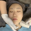 튠스타트 | 부산 서면 튠페이스 리프팅 찐후기