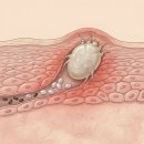 세종공주축협동물병원 | 공주 옴진드기 방역 후기｜어르신 주택 2차 집중 방역소독 완료 (미소창방역)