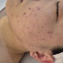 은도빌딩 | [진스킨] JinSKin 중랑구 면목동 스킨케어 리페어밸런스테라피 SOS 관리 후기