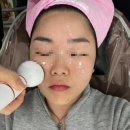 상미초등학교 | [써니뷰티] 부천 피부관리 - 색소개선 올인원 케어 후기