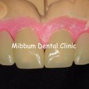 동그라미 치과기공소 이미지