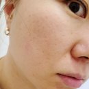 엠티에스 | 페슬로 리쥬레시피 엠티에스 롤러세럼 사용후기