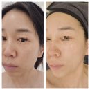 지에스25 상암제일점 | 상암 정서현에스테틱 │ 크레이지 015 고주파로 탄력·윤곽관리 받은 후기!