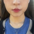 알밤바디(ALBAM BODY) | 마미케어 EMS 브이쎄라 실사용 후기(사용 방법, 1회 사용 후기 솔직 리뷰)