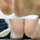 대구 칠곡 패디플래닝 잘하는 곳 뽐온뷰티 칠곡점 발각질 제거 후기