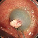 바른길내과의원 이미지