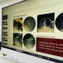 빗장미용실 | 부평 출산 후 탈모😱정수리 가르마 탈모😨고민😫타파~!두피문신[콤마더문] 골룸 가르마😭탈출~! 리얼 후기💗