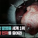 대장암 발생률 세계 1위 한국 이미지