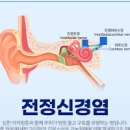 갑자기 어지럽고 식은땀 구토 어지럼증 왔다면? 이미지