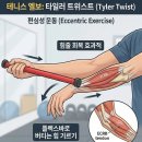 [25년 3분기] (야간)체형교정필라테스 A | [침산동피티PT,헬스장] 팔꿈치 통증, 테니스 엘보가 아닐 수도 있다?(재활운동전문가의 솔루션!)