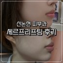 이랑고랑 | 세르프리프팅 신논현피부과 볼 패임·라인 정리 솔직 후기