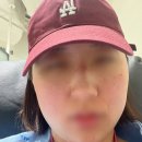 룰 | 피부염과 야차룰 뜬 후기