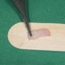 까만코 | 20대 앞니 임플란트 후기 - 까만 앞니를 하얗고 예쁘게!