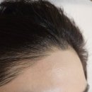 카다리나헤어라인 | 은평구 왁싱 잘하는곳 찾는다면? 연신내 체리왁싱 이마 헤어라인 후기