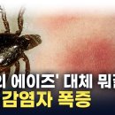 제2의 에이즈라고 불리는 라임병 이미지