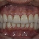 부여치과기공소 이미지