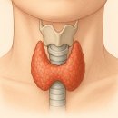 (유)로또에너지 | 갑상선암, 무병장수의 꿈을 막을쏘냐? (혹 많은 체질, 유방암, 갑상선암, 유방외과, 세침흡인검사)