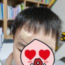 분당태권도장 | 45개월 아이 응급실 이마 봉합 후기(ft. 분당 제생병원과 전공의 사직)