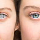 경산제일안과 이미지