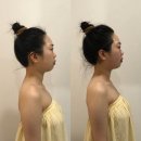 호텔오월로 | 관리효과가 넘사벽인 오월에스테틱 JH윤곽술 후기