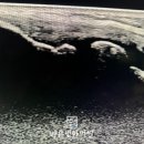 바른빛한의원 이미지